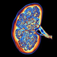Woran erkenne ich eine Niereninsuffizienz? 3D-Computertomographie (CT) einer Niere