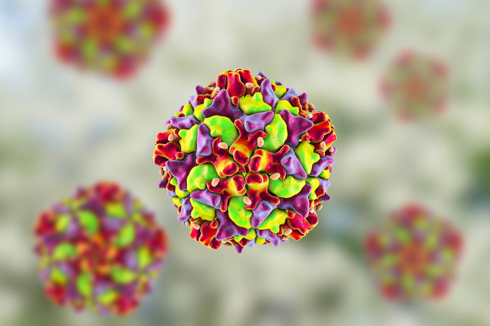 Polioviren-in-London-aufgetaucht-Was-man-ber-Kinderl-hmung-wissen-sollte