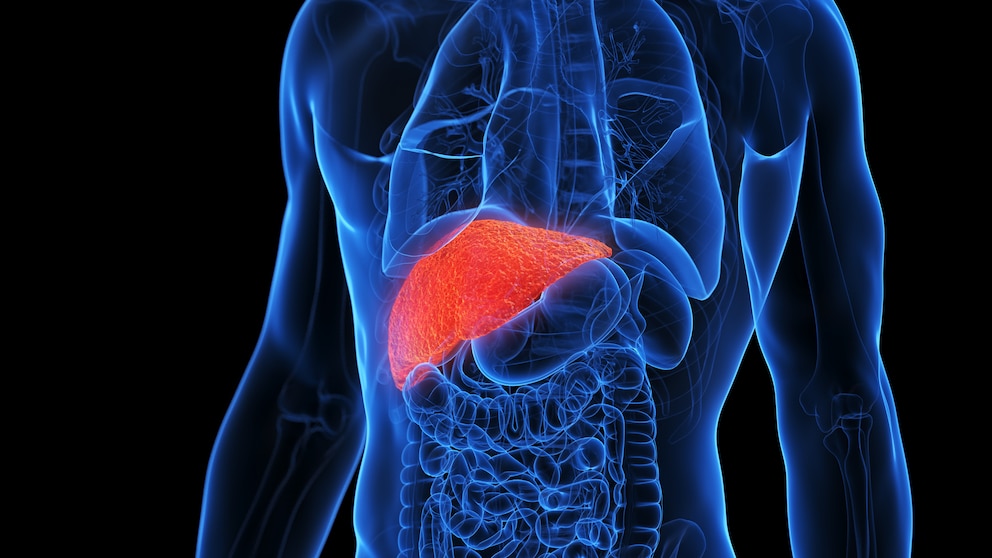 The Best Diet to Prevent Fatty Liver: New Study Reveals Key Findings